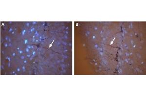 Expression of CNG3 in rat brain - Immunohistochemical staining of frozen rat hippocampal dentate gyrus (DG) sections using Anti-CNGA3 Antibody (ABIN7043091 and ABIN7044975). (CNGA3 抗体  (Intracellular))