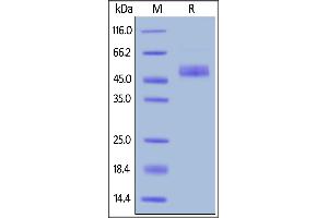 Human ICOS, Fc Tag on  under reducing (R) condition. (ICOS Protein (AA 21-141) (Fc Tag))