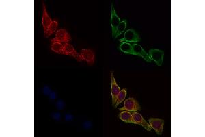 ABIN6257040 and ABIN6275770 staining HepG2 cells by IF/ICC. (IL13RA2 抗体  (C-Term))