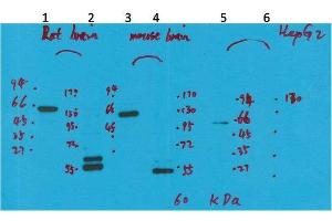 Western Blotting (WB) image for anti-Potassium Voltage-Gated Channel, Subfamily H (Eag-Related), Member 5 (KCNH5) antibody (ABIN3188070)
