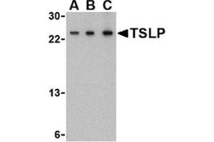 Western blot analysis of TSLP in A-20 cell lysate with this product at (A) 0. (Thymic Stromal Lymphopoietin 抗体  (Center))