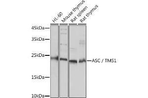 Western blot analysis of extracts of various cell lines, using ASC/TMS1 Rabbit pAb (ABIN7269756) at 1:3000 dilution.