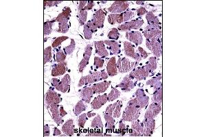 DAG1 Antibody (C-term) ((ABIN658022 and ABIN2846960))immunohistochemistry analysis in formalin fixed and paraffin embedded human skeletal muscle followed by peroxidase conjugation of the secondary antibody and DAB staining. (Dystroglycan 抗体  (C-Term))