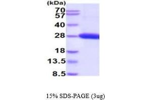 UL16 Binding Protein 1 (ULBP1) (AA 26-216) protein (His tag)