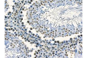 ABIN7095242 and ABIN7099299 at 1/100 staining rat testis tissue by IHC-P. (RNF43 抗体)
