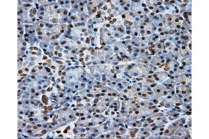 Immunohistochemical staining of paraffin-embedded Kidney tissue using anti-DAPK2 mouse monoclonal antibody. (DAPK2 抗体)