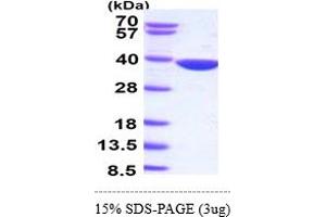 SDS-PAGE (SDS) image for Aldo-Keto Reductase Family 1, Member B10 (Aldose Reductase) (AKR1B10) (AA 1-316) protein (ABIN667103) (AKR1B10 Protein (AA 1-316))
