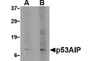 Western Blotting (WB) image for anti-P53-Regulated Apoptosis-Inducing Protein 1 (TP53AIP1) (N-Term) antibody (ABIN1031499) (TP53AIP1 抗体  (N-Term))