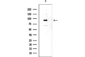 Western blot analysis of lysates from COLO205 cells, using TRPC1 Mouse Monoclonal Antibody at 1/1000 dilution.