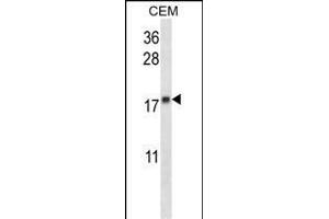 MGMT Antibody (N-term) (ABIN657769 and ABIN2846745) western blot analysis in CEM cell line lysates (35 μg/lane). (MGMT 抗体  (N-Term))