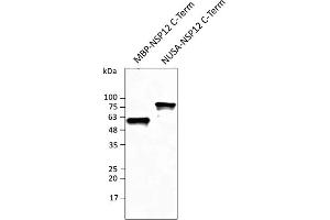 Western Blotting (WB) image for anti-SARS-CoV-2 RNA-dependent RNA Polymerase (NSP12) (SARS-CoV-2 RdRP) (C-Term) antibody (ABIN7273004) (SARS-CoV-2 NSP12 (RdRP) 抗体  (C-Term))