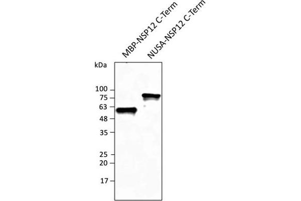 SARS-CoV-2 NSP12 (RdRP) 抗体  (C-Term)