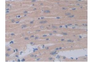 IHC-P analysis of Mouse Heart Tissue, with DAB staining. (Occludin 抗体  (AA 17-107))