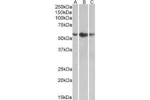 ABIN2560469 (0. (TNFRSF1A 抗体  (Internal Region))