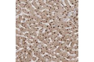 Immunohistochemical staining of human liver with AOF1 polyclonal antibody  shows nuclear and cytoplasmic positivity in hepatocytes. (KDM1B 抗体)
