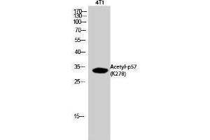 Western Blotting (WB) image for anti-P57 (acLys278) antibody (ABIN3181900) (P57 (acLys278) 抗体)