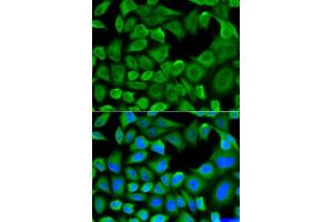 Immunofluorescence analysis of HeLa cells using BCL2L11 antibody. (BIM 抗体)