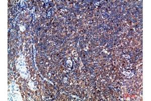Immunohistochemistry (IHC) image for anti-Tryptase delta 1 (TPSD1) (AA 51-100) antibody (ABIN7189089)