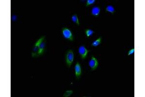 Immunofluorescence staining of A549 cells with ABIN7154684 at 1:200, counter-stained with DAPI. (GNGT2 抗体  (AA 1-66))