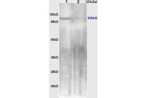 L1 mouse small intestine lysates L2 rat brain lysates probed with Anti NFkB Inducing Kinase NIK Polyclonal Antibody, Unconjugated (ABIN724520) at 1:200 overnight at 4 °C. (MAP3K14 抗体  (AA 901-947))