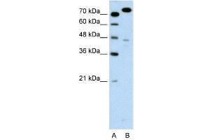 WB Suggested Anti-MCM3  Antibody Titration: 0. (MCM3 抗体  (C-Term))