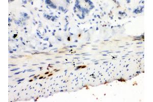 Immunohistochemistry (IHC) image for anti-Signal Transducer and Activator of Transcription 6, Interleukin-4 Induced (STAT6) (AA 13-29), (N-Term) antibody (ABIN3044265)