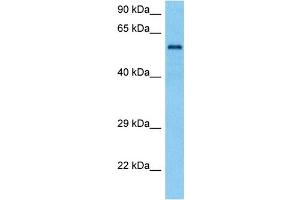 Western Blotting (WB) image for anti-Tyrosinase-Related Protein 1 (TYRP1) (Middle Region) antibody (ABIN2781815)