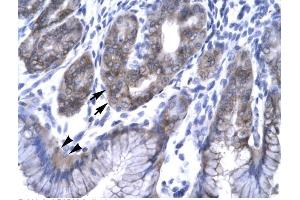 Human Stomach; Rabbit Anti-EAP30 Antibody. (SNF8 抗体  (N-Term))