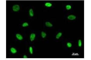 Immunostaining analysis in HeLa cells. (GTF3C2 抗体)