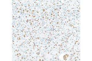 Immunohistochemistry (IHC) image for anti-RNA Binding Motif Protein 9 (RBM9) (AA 1-50) antibody (ABIN7454009) (Recombinant RBM9 抗体  (AA 1-50))