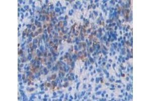 Used in DAB staining on fromalin fixed paraffin- embedded Kidney tissue (VAV1 抗体  (AA 565-795))