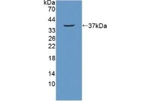 Detection of Recombinant NUP214, Mouse using Polyclonal Antibody to Nucleoporin 214 kDa (NUP214) (NUP214 抗体  (AA 601-868))