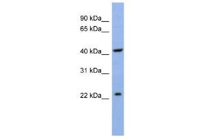 WB Suggested Anti-SLC35F1 Antibody Titration:  0. (SLC35F1 抗体  (N-Term))