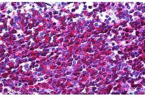 Human Spleen: Formalin-Fixed, Paraffin-Embedded (FFPE) (IL16 抗体)