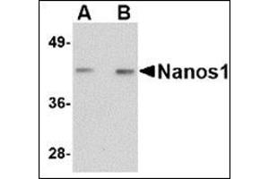 Western blot analysis of Nanos1 in rat brain tissue lysate with this product at (A) 1 and (B) 2 μg/ml. (Nanos Homolog 1 抗体  (Center))