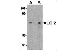 Western blot analysis of LGI2 in 293 cell lysate with this product at (A) 1 and (B) 2 μg/ml. (LGI2 抗体  (N-Term))