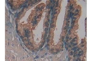 Detection of FUCa1 in Human Prostate Tissue using Polyclonal Antibody to Fucosidase Alpha L1, Tissue (FUCa1) (FUCA1 抗体  (AA 53-289))