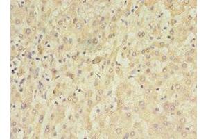 Immunohistochemistry of paraffin-embedded human liver tissue using ABIN7159638 at dilution of 1:100 (TET3 抗体  (AA 72-335))