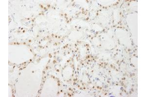 Immunohistochemistry (IHC) image for anti-General Transcription Factor IIIC, Polypeptide 4 (GTF3C4) (AA 625-675) antibody (ABIN7448587)