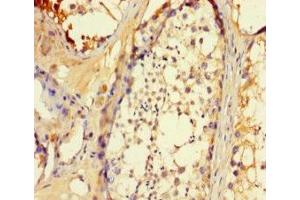 Immunohistochemistry of paraffin-embedded human testis tissue using ABIN7145717 at dilution of 1:100 (SLC25A14 抗体  (AA 55-111))