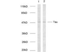Western blot analysis of extracts from HeLa cells, using Tau (Ab-214) Antibody. (tau 抗体  (AA 501-550))