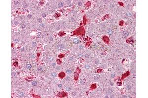 Anti-Antithrombin III antibody IHC of human liver. (SERPINC1 抗体  (AA 143-192))
