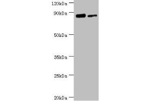 Western blot All lanes: TFIIH basal transcription factor complex helicase XPD subunit antibody at 2 μg/mL Lane 1: 293T whole cell lysate Lane 2: K562 whole cell lysate Secondary Goat polyclonal to rabbit IgG at 1/10000 dilution Predicted band size: 87, 47 kDa Observed band size: 87 kDa (ERCC2 抗体  (AA 1-300))
