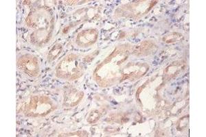 Immunohistochemistry of paraffin-embedded human kidney tissue using ABIN7167461 at dilution of 1:100 (ErbB2/Her2 抗体  (AA 153-598))