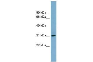 RNF144B antibody used at 1 ug/ml to detect target protein. (RNF144B 抗体  (Middle Region))