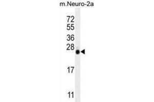 Western Blotting (WB) image for anti-Lin-28 Homolog A (C. Elegans) (LIN28A) antibody (ABIN2996249) (LIN28A 抗体)