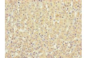 Immunohistochemistry (IHC) image for anti-Succinate Receptor 1 (SUCNR1) (AA 303-334) antibody (ABIN7170906)