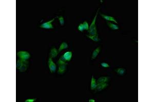 Immunofluorescent analysis of Hela cells using ABIN7168925 at dilution of 1:100 and Alexa Fluor 488-congugated AffiniPure Goat Anti-Rabbit IgG(H+L) (SPINK1 抗体  (AA 19-79))