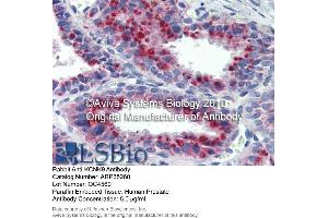 Immunohistochemistry (IHC) image for anti-Potassium Channel, Subfamily K, Member 9 (KCNK9) (N-Term) antibody (ABIN2776216) (KCNK9 抗体  (N-Term))