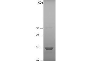 Western Blotting (WB) image for Fatty Acid Binding Protein 2, Intestinal (FABP2) (AA 2-132) protein (His tag) (ABIN7122892)